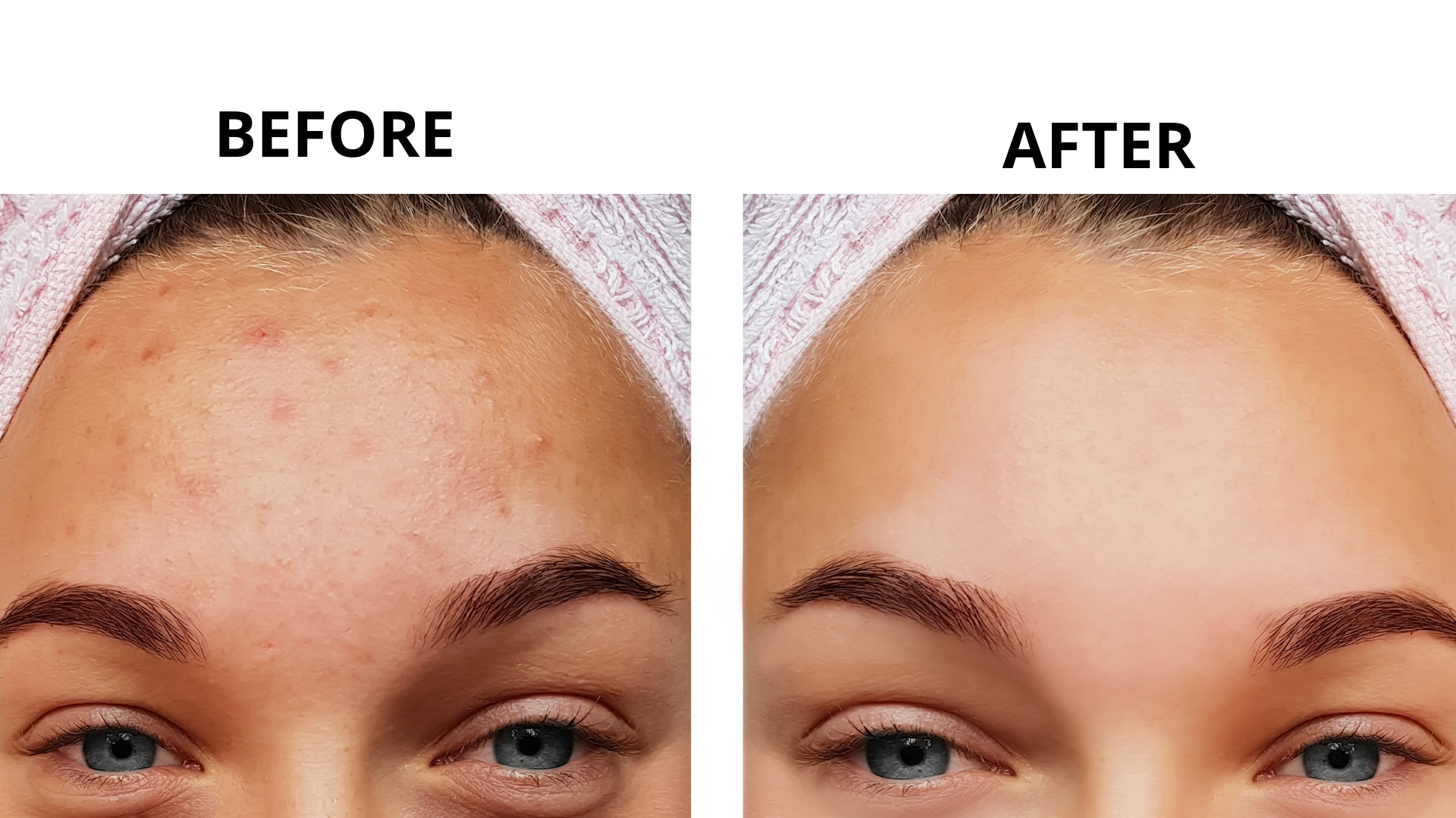 Dermapuritys